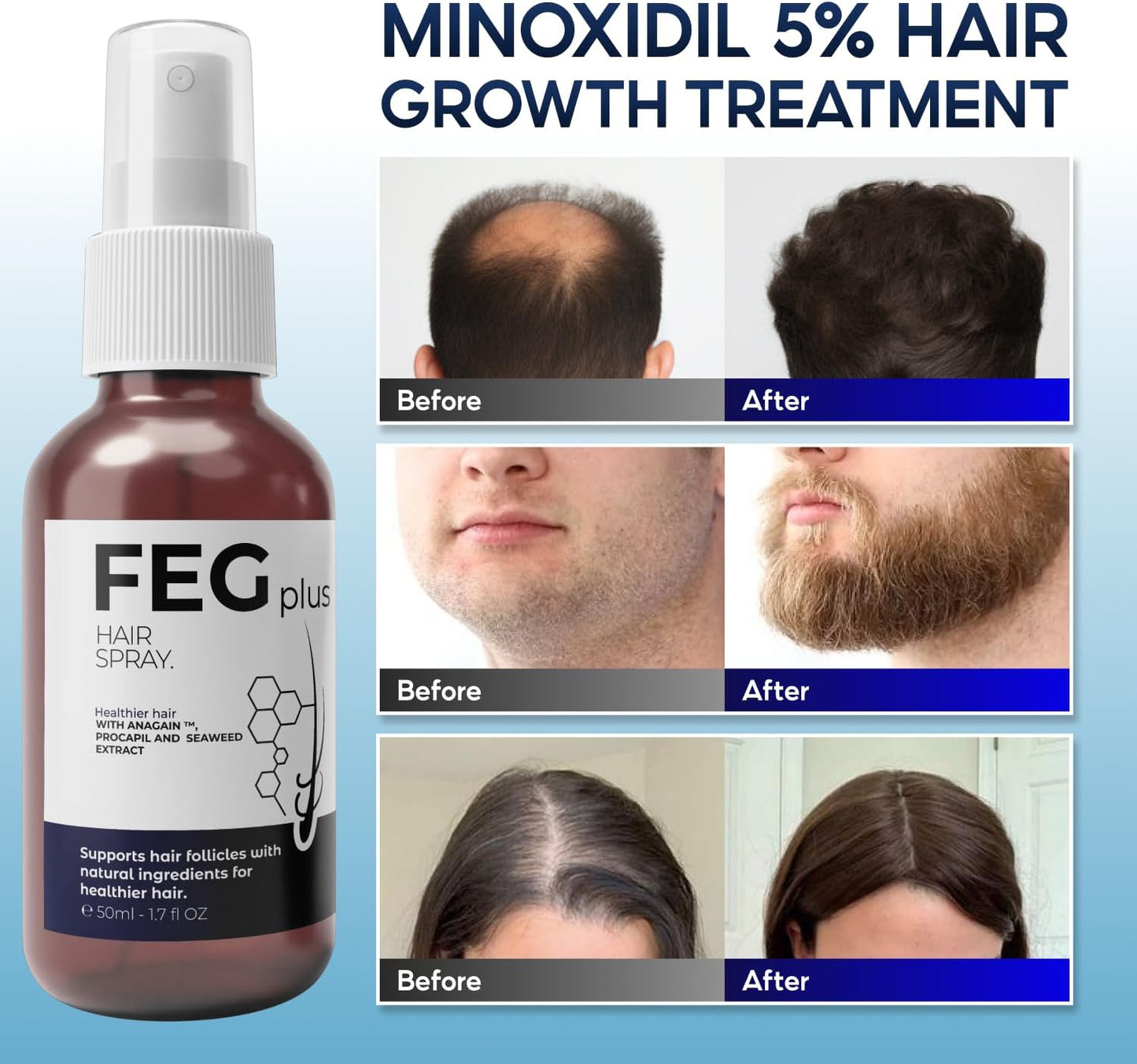 FEG® Advanced Hair Growth Spray – Revitalize Roots & Boost Thickness - Urban Sale