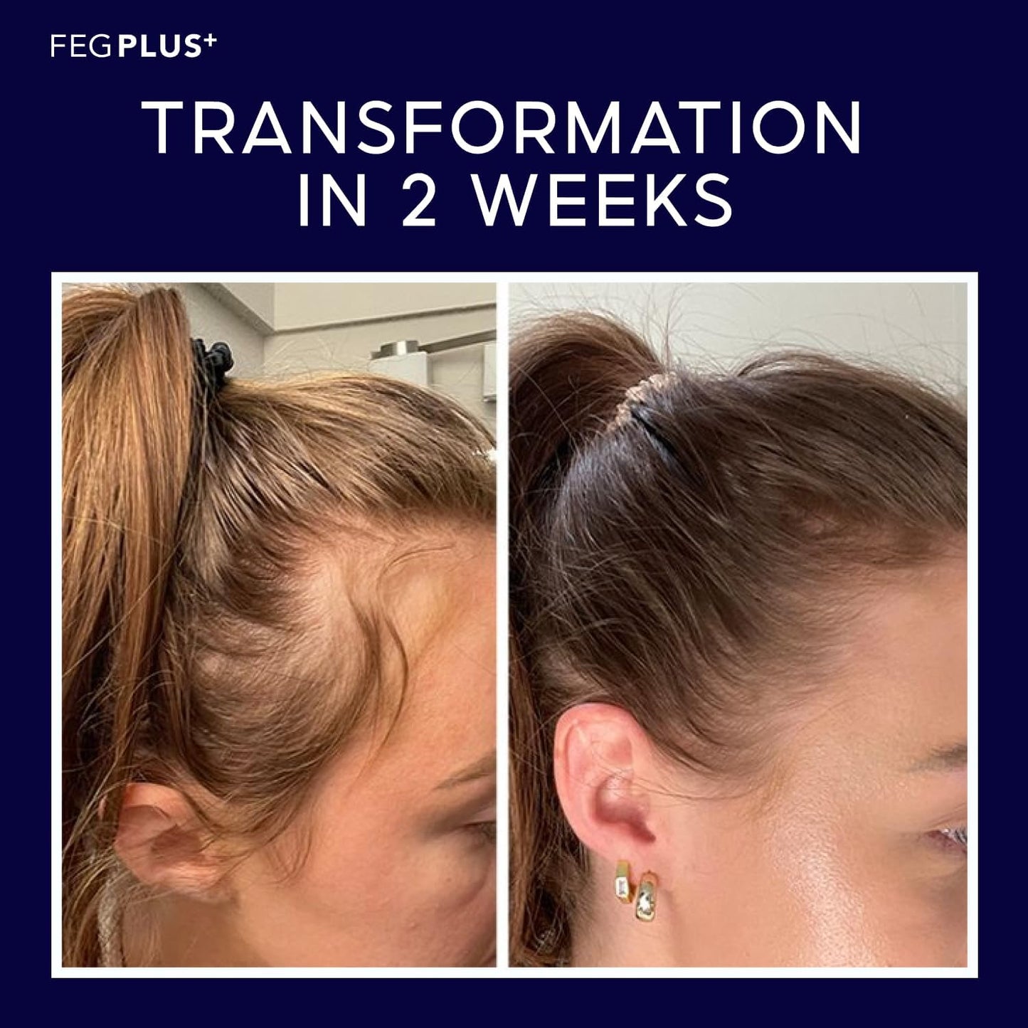 FEG® Advanced Hair Growth Spray – Revitalize Roots & Boost Thickness - Urban Sale
