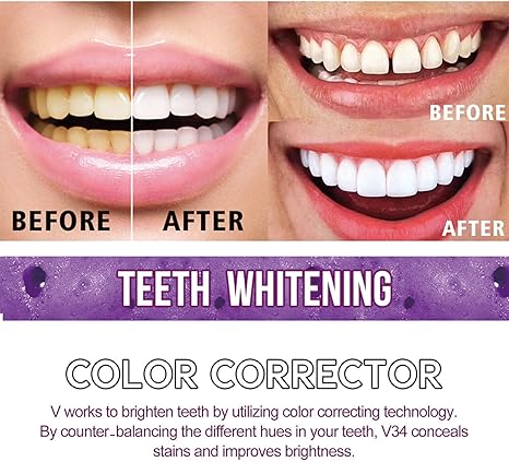 Toothpaste for Teeth Whitening (30ml) - Urban Sale