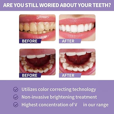 Toothpaste for Teeth Whitening (30ml) - Urban Sale