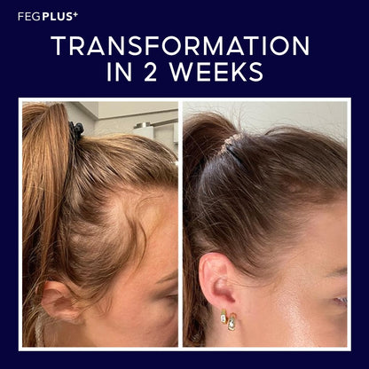 FEG® Advanced Hair Growth Spray – Revitalize Roots & Boost Thickness - Urban Sale