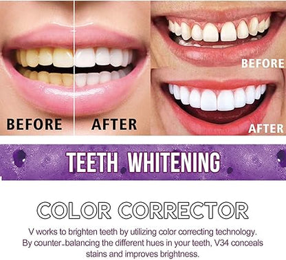 Toothpaste for Teeth Whitening (30ml) - Urban Sale